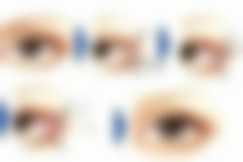 头发种植本身能解决什么、不能解决什么?