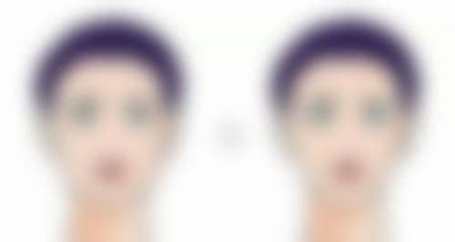 打除皱针青啦几天能好？一般3 - 7天可消退，恢复时间与个人体质和护理有关！多久打一次最好也有门道 