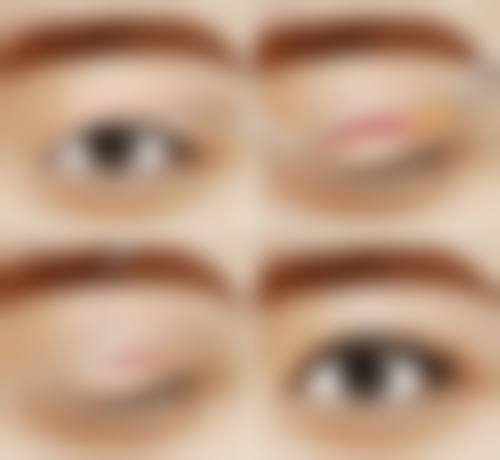 十、选择卢尚兵修复双眼皮相关医院与医生时，应重点看哪些维度？