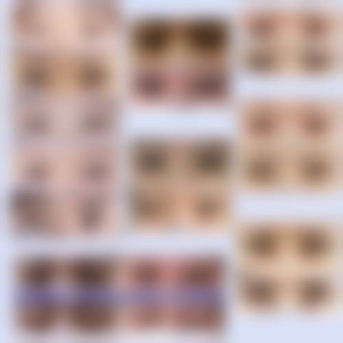 激光去眼袋常见并发症或后遗问题，在临床中如何理解其发生概率？