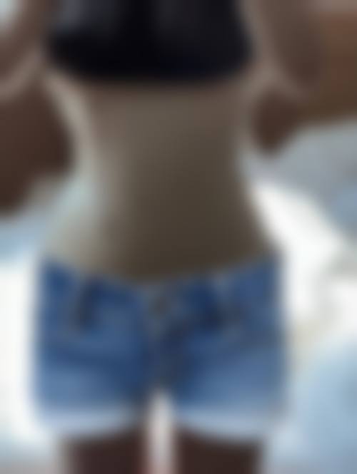 腰腹吸脂有哪些优点和缺点?