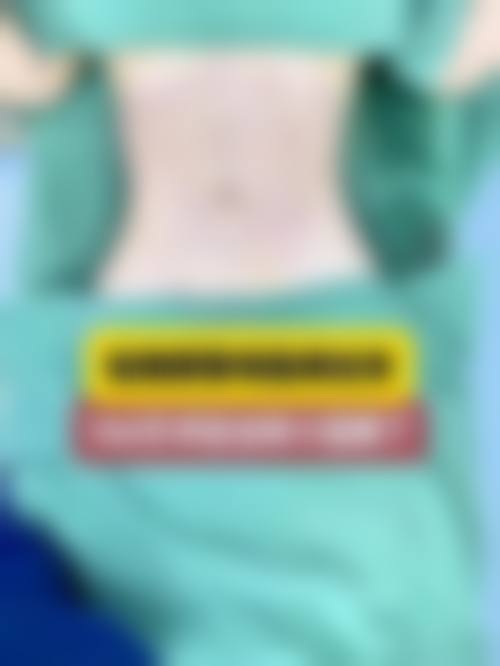 腰腹吸脂后需要注意什么?