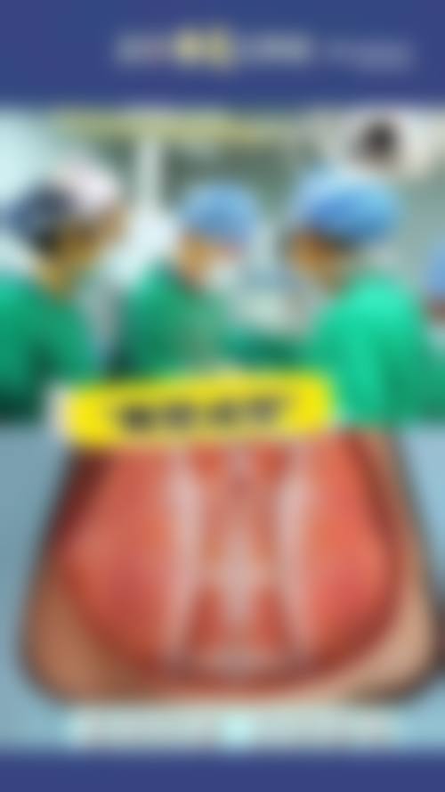 腰腹吸脂适合哪些人群?