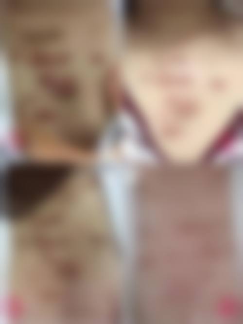 真人成功实例,见证疤痕青年的入伍梦想成真