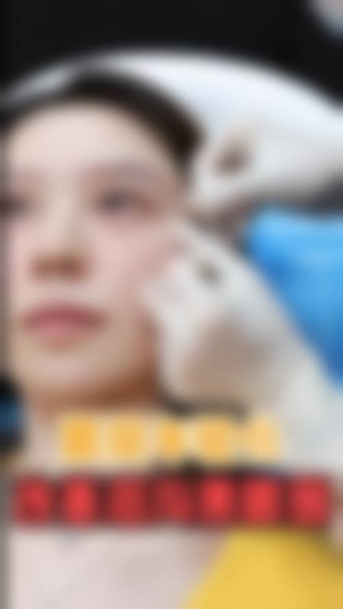 激光去眼袋的常见认知偏差与误解