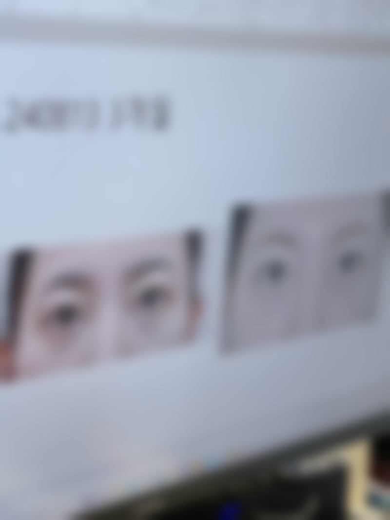 哪些人群在评估中更可能被建议考虑打除皱针