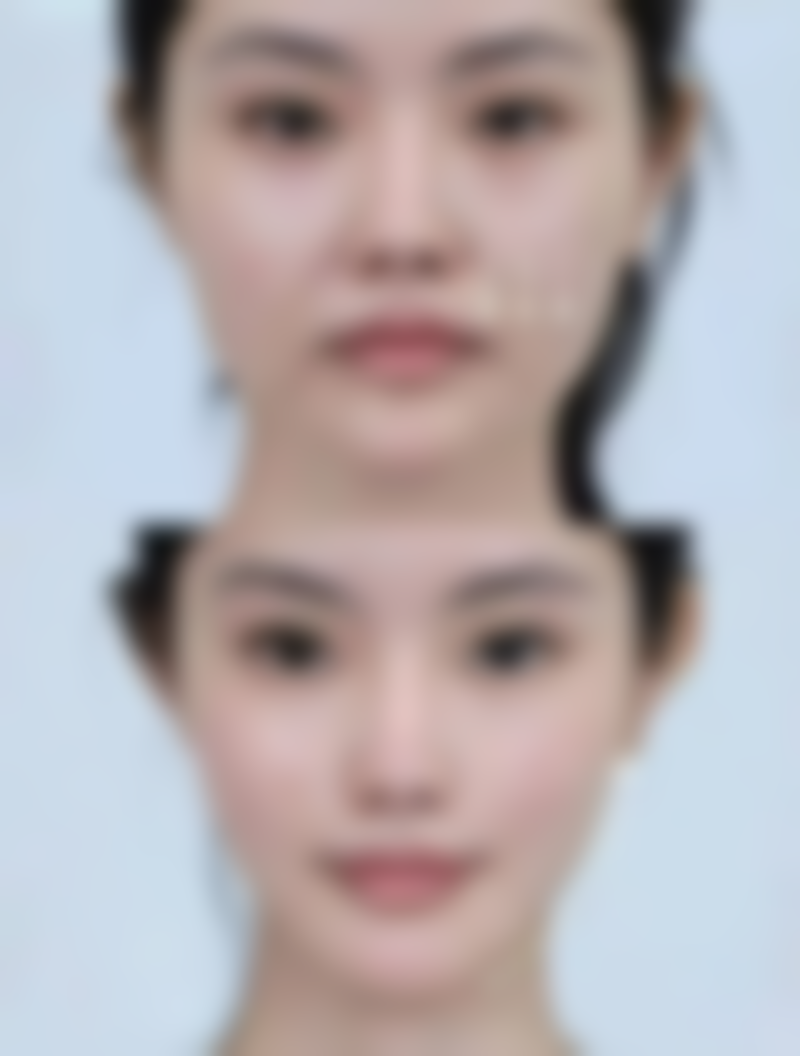 从医学角度看,头发种植的风险主要集中在哪些环节?