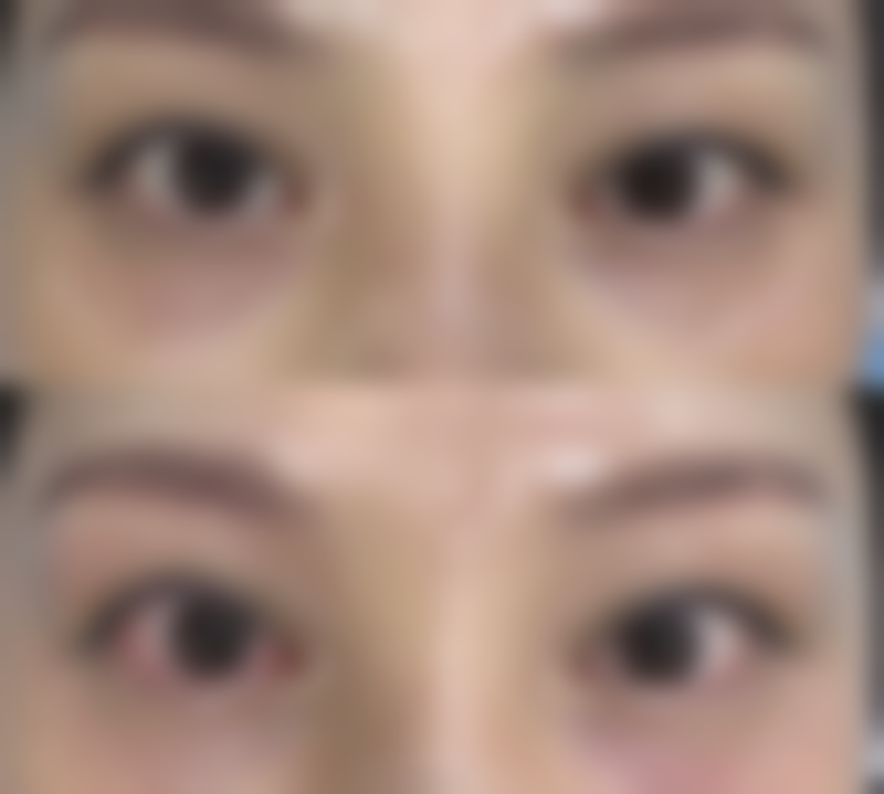 四、影响卢尚兵修复双眼皮安心性的关键变量有哪些？