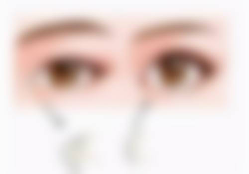 眼部解剖结构特殊对双眼皮手术的影响