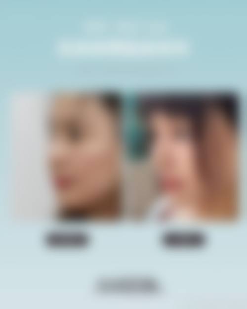 隆鼻手术几天出院？不同手术方式的差异