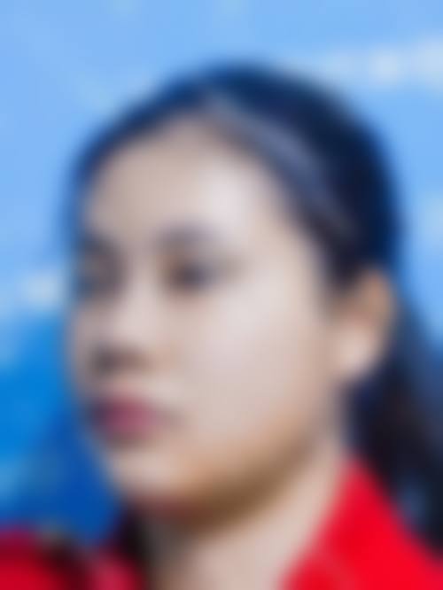 膨体自然贴合度高，如何保护其安心性？