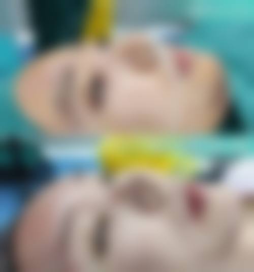 十、选择一次性双眼皮相关医院与医生时,应重点看哪些维度?