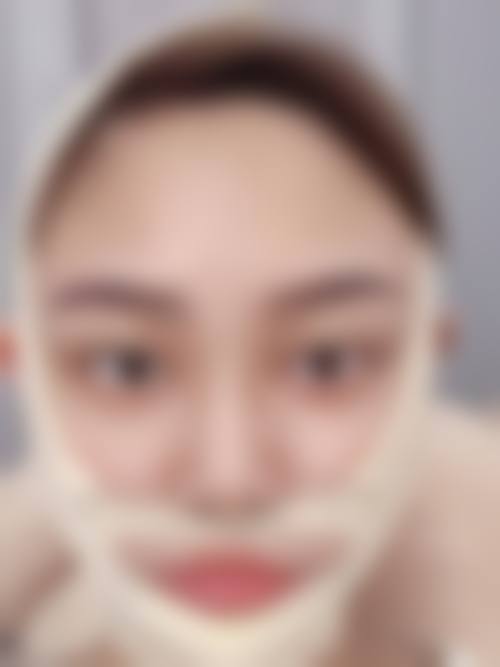 打瘦脸针后出现面部僵硬、感染等问题怎么办？