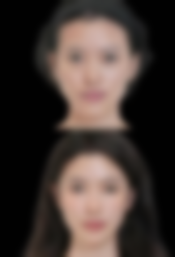 双眼皮割深修复手术本身能解决什么、不能解决什么？