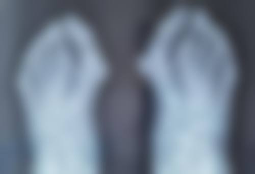 丰太阳穴的常见认知偏差与误解