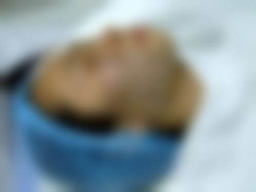 正视瘦脸针长期打的危害:这些坑一定要提前避开