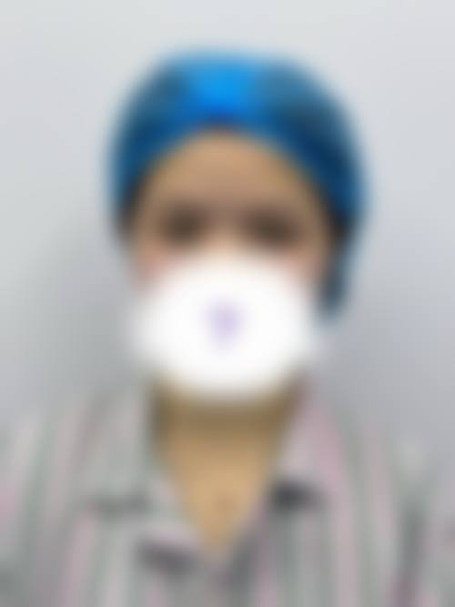 手术修复双眼皮线结反应,精细处理不踩坑!