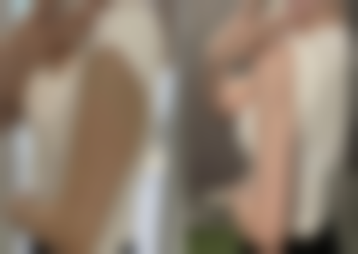 {手臂吸脂要穿多久塑身衣？答案是通常1-3个月，时间长短受吸脂量、恢复状况等影响
前2周需全天穿，之后可仅白天穿戴