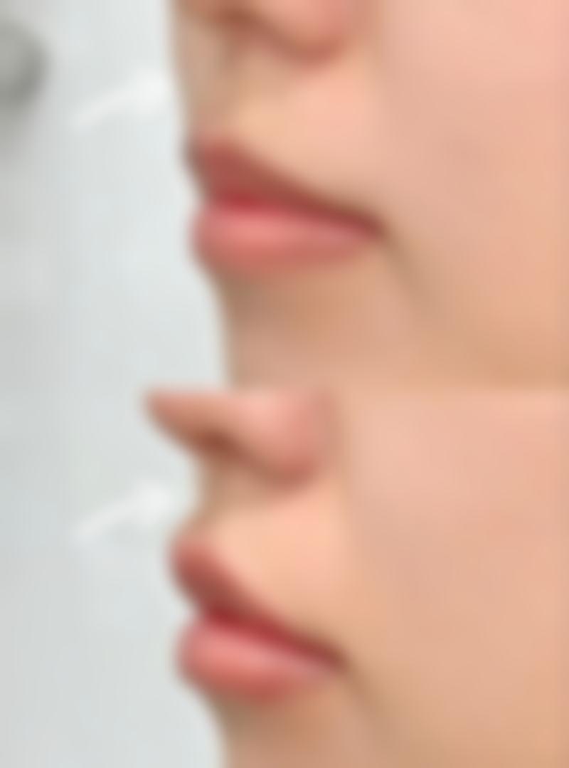 哪些情况通常不被认为是合适指征?