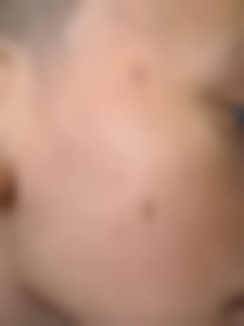 十、选择点痣疤痕修复相关医院与医生时,应重点看哪些维度?