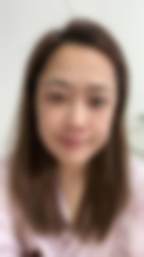 去眼袋外切法的特点与价格