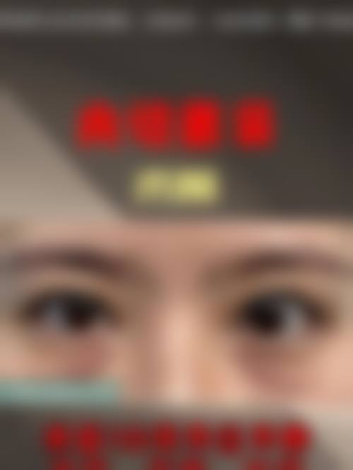 去眼袋会去掉卧蚕吗？采用正确方法不会！专业设备与操作可精准去眼袋保留卧蚕；内切法3000起，外切法5000起，多方法还能塑造放大卧蚕！ 