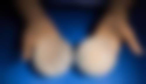 隆胸手术有哪些优缺点？