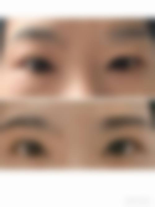 哪些情况通常不被认为是合适指征？