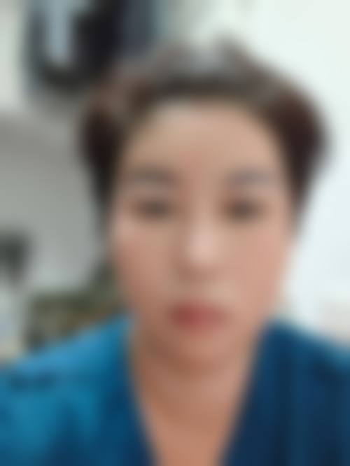 下眼袋肿胀消除方法的常见认知偏差与误解