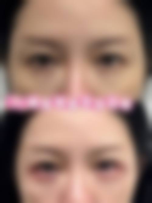 按摩热敷、充足睡眠加眼霜的价格区间及费用差异来源