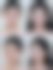 在决定是否选择隆鼻和眼睛联合手术前,普通用户更容易忽略的关键评估点