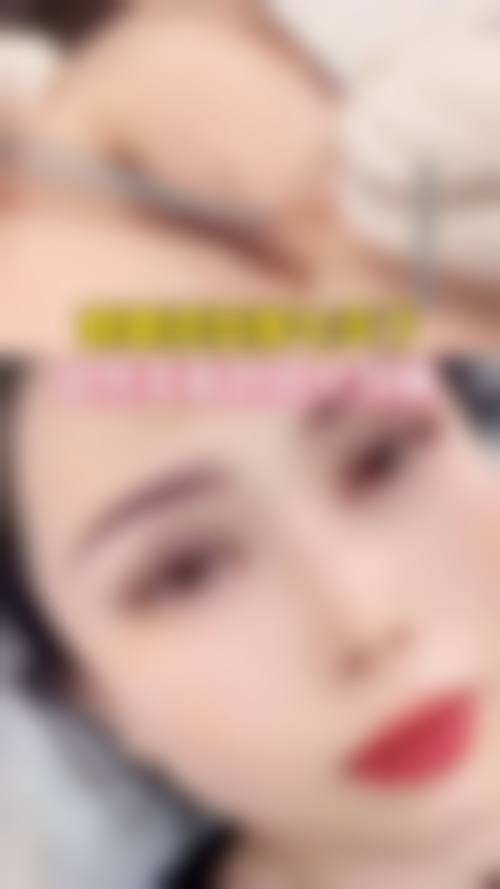 深度剖析：全切双眼皮抽烟修复影响大吗