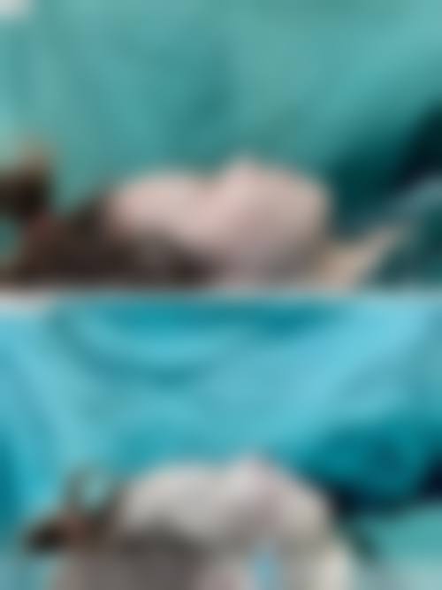 线提升隆鼻吸收后做假体，如何预约挂号？