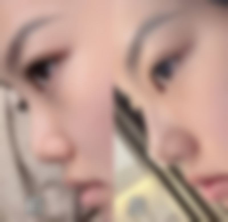 那些罕见却致命的重度并发症