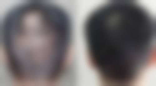 上海艺星医疗整形美容医院特色解读