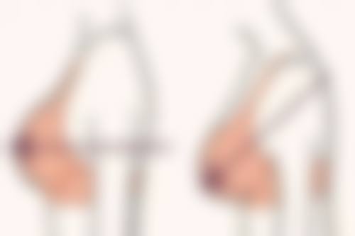 上海地区排名第一的上海华美医疗美容医院项目收费价目表