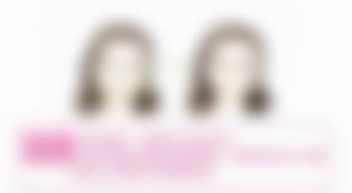 佛山正规医院玻尿酸除皱针价格明细及相关情况