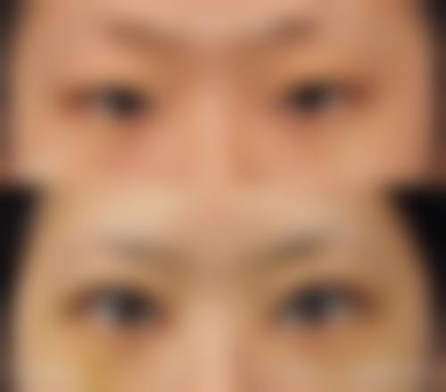 沈阳北方整形外科医院免费预约挂号！这家医院正规靠谱吗？当然靠得住啦！ 