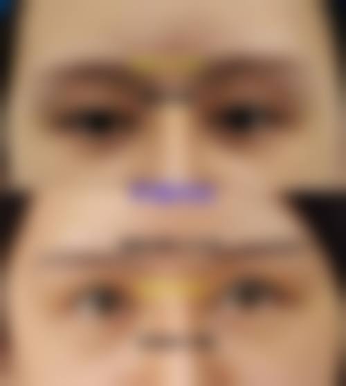 总结：成都恒博天姿医疗美容门诊部靠谱吗？口碑良好技术可靠，值得闭眼冲！