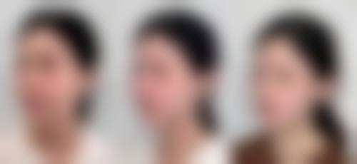 成都恒博天姿医疗美容门诊部靠谱吗？从手术成效看实力