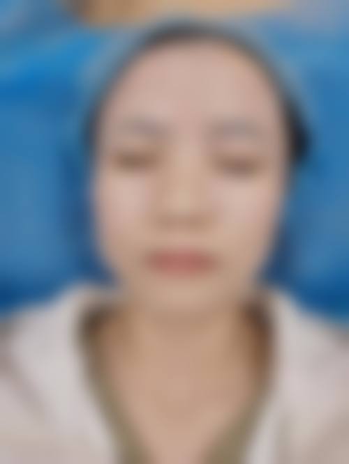 深圳艺星蒲翠玲医生：皮肤美容实力派！擅长项目+治疗成效大公开！