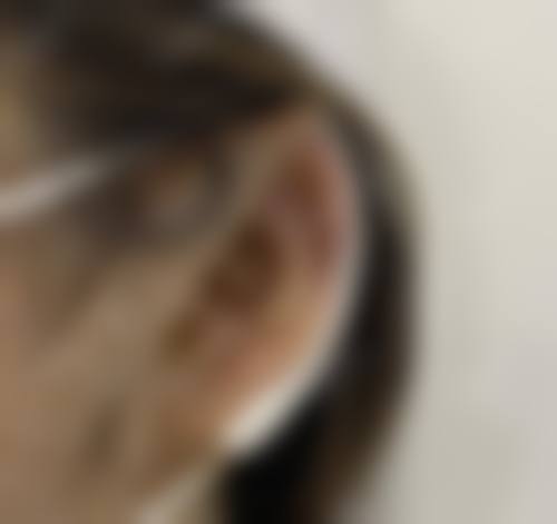 耳再造国内比较好的医院