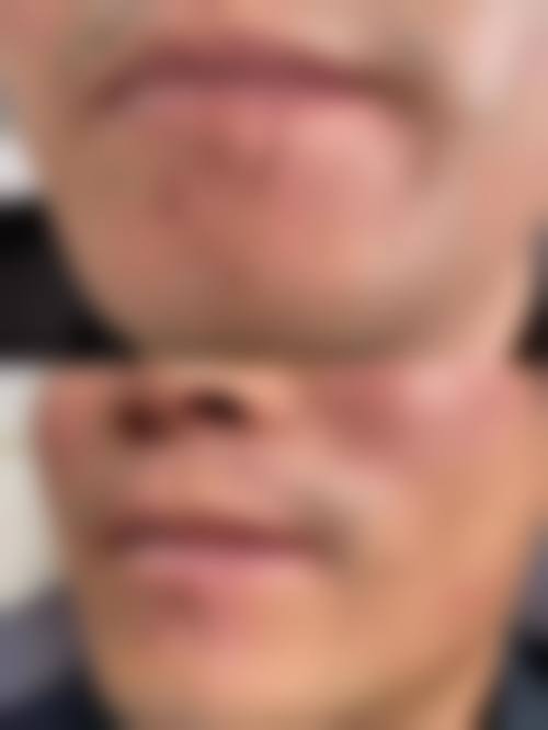 苏州双眼皮修复医生排名榜前十：榜单上最厉害的三个医生是谁？刘余宏、虞国锋、金志涅实力出圈！ 