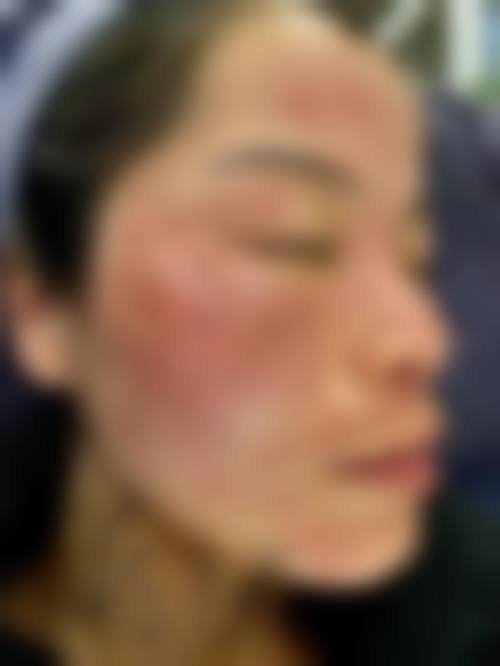 如何判断激光祛斑报价是否合理？