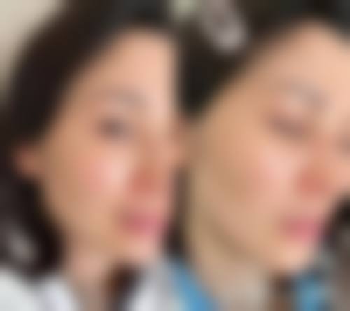 激光祛斑价格差异的核心决定因素