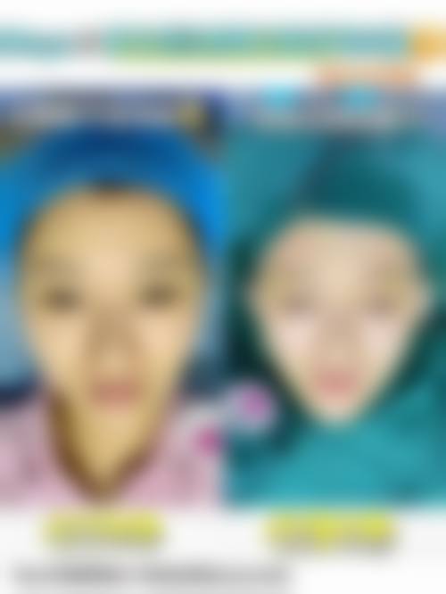 国内耳再造手术谁做得好