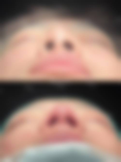 深圳艺星正规吗？资质+设备+口碑，三重保护让你放心变得更美！