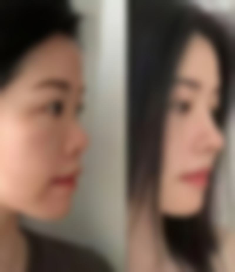 成都恒博天姿医疗美容门诊部靠谱吗？口碑见证实力