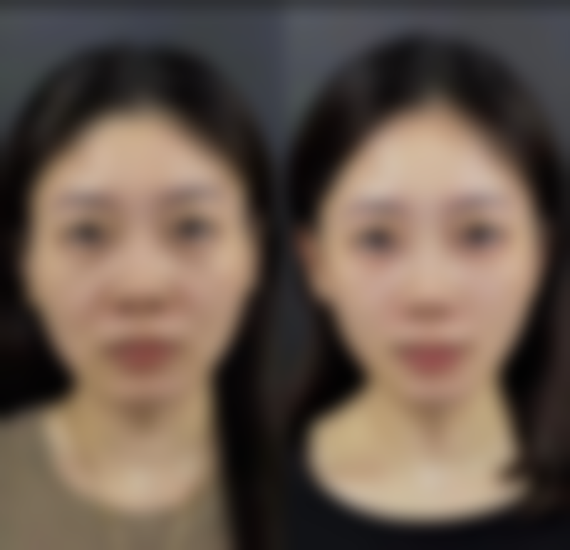 如何选择丰太阳穴的医院和医生