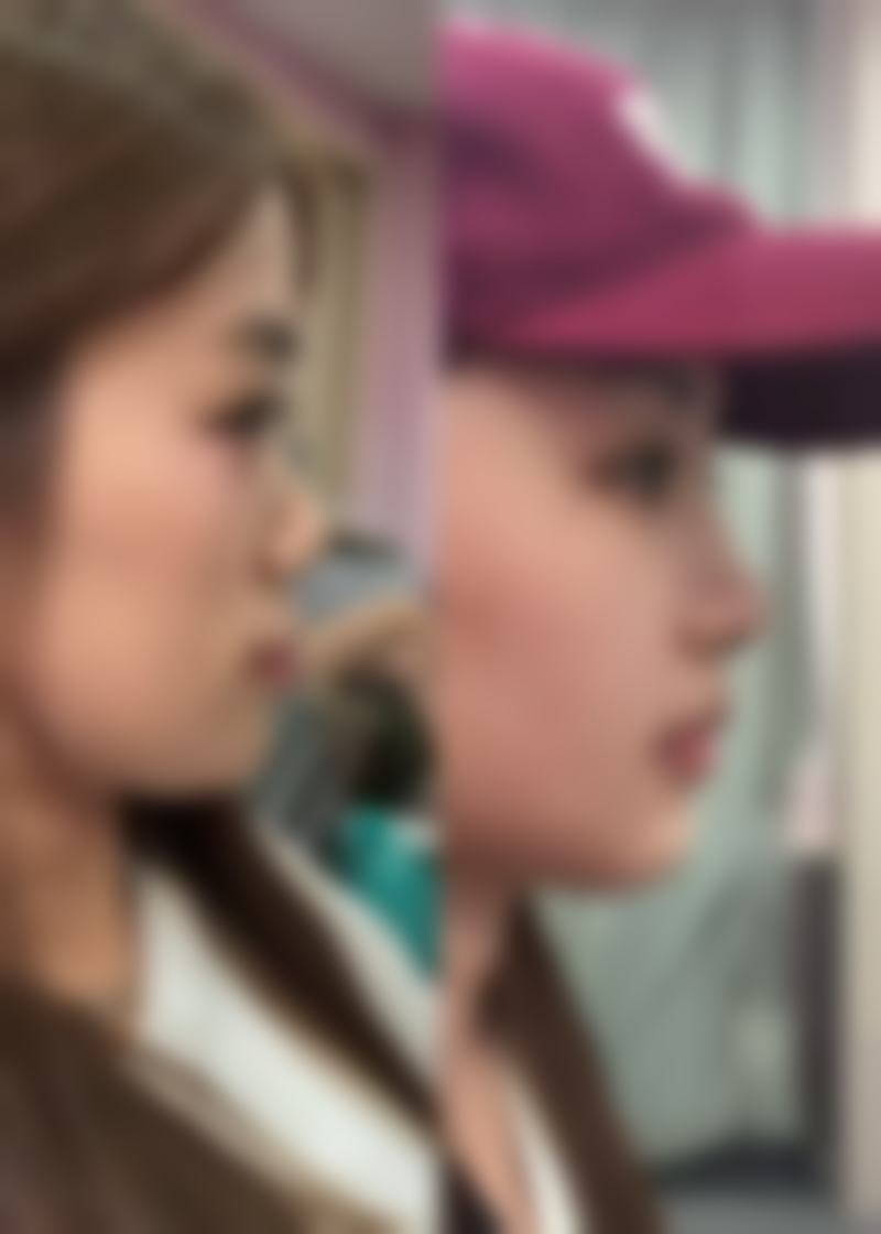 成都恒博天姿整形医院：精良技术保护手术成效